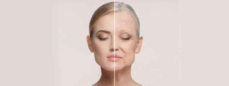 Plasma Skin Tightening